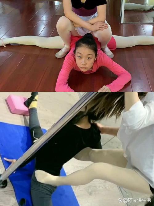 女孩学舞蹈受伤，是天赋不足还是训练不当？-第1张图片-泰美艺术培训